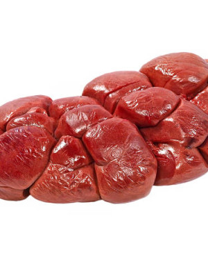 Kidney